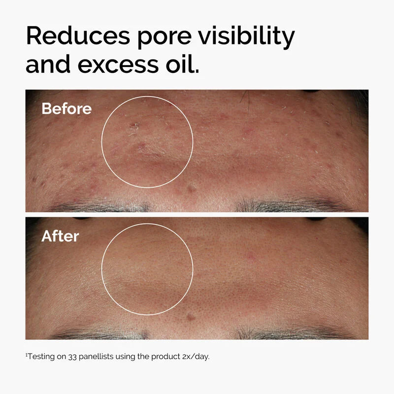 Niacinamide 10% + Zinc 1% photo 4
